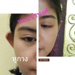 Rangsit Aesthetic Plastic Surgery Clinic