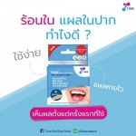 จำหน่ายแผ่นแปะแผลร้อนในที่ลิ้น - แผ่นแปะร้อนใน - บริษัท 3ที เนเชอเฮิร์บ จำกัด