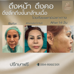 Meeyou Clinic Medicine Company Limited