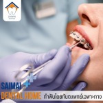คลินิกจัดฟันสายไหม - คลินิกทันตกรรมหมอฟันสายไหมเดนทัลโฮม