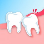 การผ่าฟันคุด การถอนฟัน - คลินิกทันตกรรมเด็นทัลวิลลา ชลบุรี