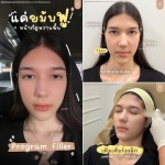 Filler อินทามระ - บริษัท เคเจ คลินิก จำกัด