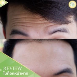 โบท็อกหน้าฝาก เชียงราย