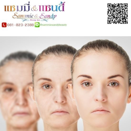 Face-lift ยกหน้าโดยไม่ต้องผ่าตัด