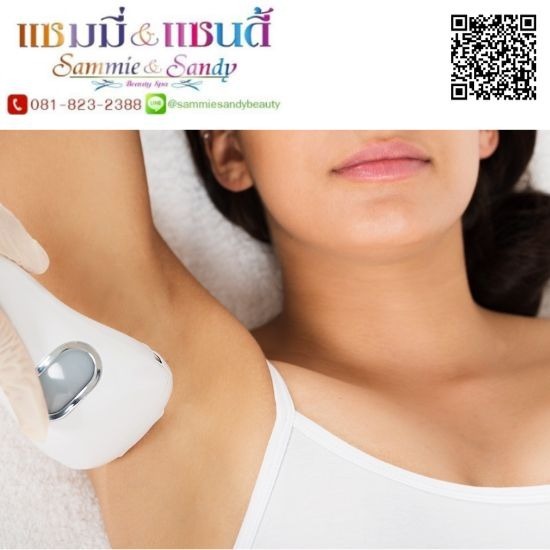 เลเซอร์กำจัดขนถาวร (Laser hair removal)