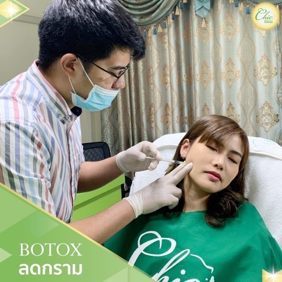 Botox ลดกราม เชียงราย Botox ลดกราม เชียงราย 